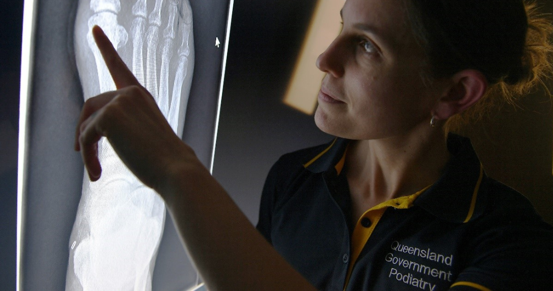 APodA congratulates Queensland Health’s step forward to build regional podiatry workforce